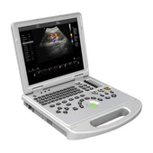 4D farve digital bærbar ultralydsscanner for hjerte