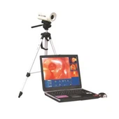 Bærbart Video Colpscope