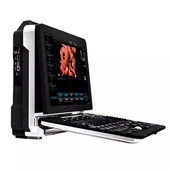 Hot Selling Notebook Hospital Medicinsk Bærbar Ultralyd 4D Farve Doppler 15 Tommer Led-skærm