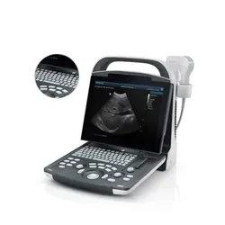 Mindray Dp-10 B/W Digital Ultrasound Scanner Portable Ultrasound Machine Price Mindray Dp-10 B/W Digital Ultrasound Scanner Portable Ultrasound Machine Price